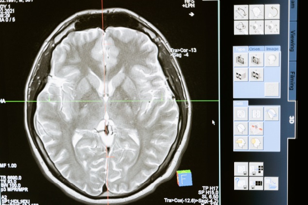 Epilessia e sonno al centro del 49° Convegno Nazionale LICE